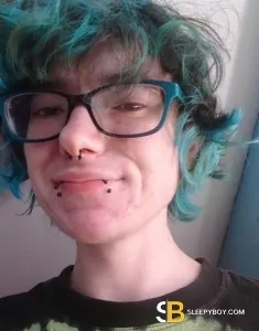 transgender (FTM) top surgery Leeds Tommy